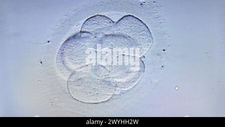 Embryoauswahl für IVF, URA, ARU, Einheit für assistierte Reproduktion, in-vitro-Fertilisation, Intrazytoplasmatische Spermieninjektion, Krankenhaus Donostia, San Sebastian, Gipuzkoa, Baskenland, Spanien. Stockfoto