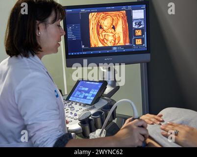 Ultraschalldiagnostik Systeme, Ultraschall 4d, Krankenhaus, Donostia, San Sebastian, Gipuzkoa, Baskenland, Spanien. Stockfoto