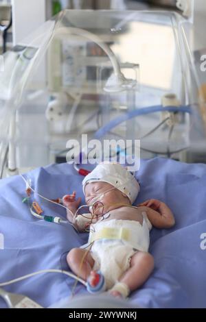 Neugeborene, Neugeborene Intensivstation, Donostia Hospital, San Sebastian, Donostia, Gipuzkoa, Baskenland, Spanien. Stockfoto