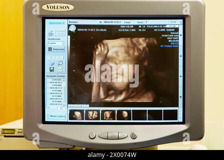 3D geburtshilflicher Ultraschall eines Fetus, 4D Baby Scan zeigt Bewegung, Gynäkologie, Krankenhaus Policlinica Gipuzkoa, San Sebastian, Donostia, Euskadi, Spanien. Stockfoto