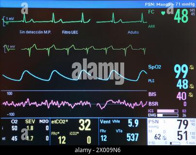 Vitalparameter Bildschirm, Chirurgie, OP, Onkologikoa Krankenhaus, Onkologikoa Institut, Fallzentrum für Prävention, Diagnose und Behandlung von Krebs, Donostia, San Sebastian, Gipuzkoa, Baskenland, Spanien, Europa. Stockfoto