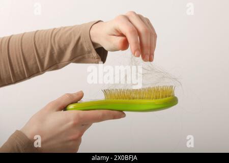 Eine Frau, die eine Haarbürste mit Haarausfall hält. Haarausfall Stockfoto