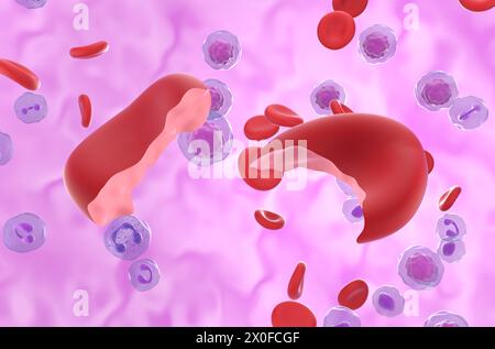 Hämolytische Anämie (HA) Zellen im Blutfluss - Nahaufnahme 3D Illustration Stockfoto