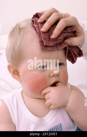 Das Baby trägt eine Weste mit roten Wangenwunden und hohen Temperaturen. Das feuchte Tuch wird von Hand auf die Stirn gebohrt, um das Kind abzukühlen Stockfoto