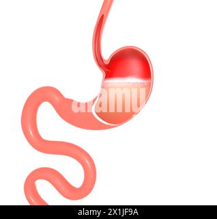 Anatomische 3D-Darstellung des Magens bei der Verdauung. Mit Sodbrennen und Reflux. Ausschnitt auf weißem Hintergrund. Stockfoto