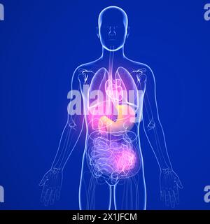 3D-Darstellung des Magens mit Sodbrennen und Reflux. In einem menschlichen Körper und transparenten Glasinneren Organen. Dunkelblauer Hintergrund. Stockfoto