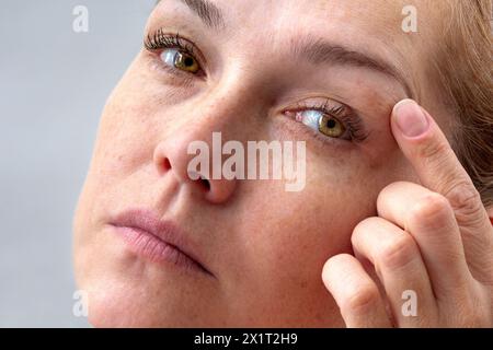 weiße 40-jährige, die Finger auf den Augenlidern hält, um das Altern der Augen zu zeigen Stockfoto