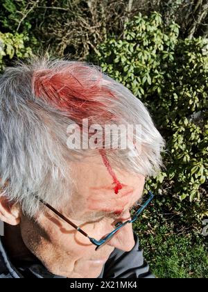 Blut auf dem Kopf eines alten Mannes Stockfoto
