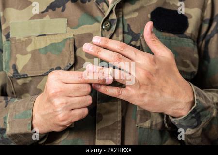 Hände eines männlichen Soldaten, der kurz davor ist, seinen Ehering abzunehmen. Stockfoto