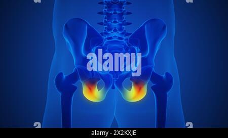 Menschliches Skelett und schmerzhafte Hüftgelenkschmerzen Stockfoto