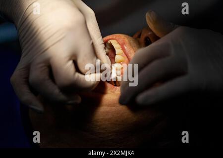 Ein erwachsener Mann wird von einem Zahnarzt gesehen Stockfoto