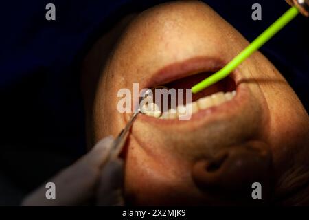 Ein erwachsener Mann wird von einem Zahnarzt gesehen Stockfoto