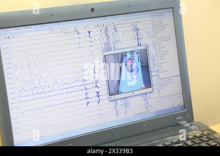 Laptop-Bildschirm mit Programm zur Aufzeichnung der Ergebnisse der elektrischen Aktivität des Gehirns Stockfoto