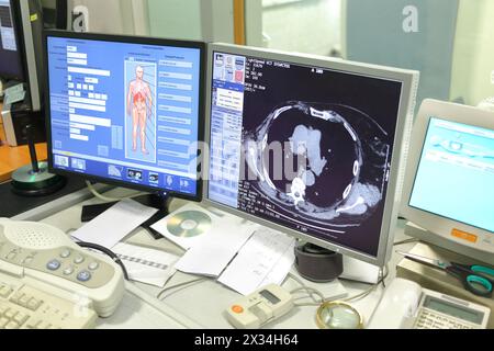 MOSKAU - 31. August 2015: Monitor in der radiologischen Röntgenuntersuchung in der multidisziplinären Klinik CELT Stockfoto