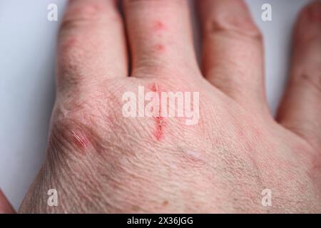 Nahaufnahme der zerkratzten Hand eines Tierbesitzers. Selektiver Fokus Stockfoto