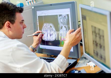 IMRT, intensitätsmodulierte Strahlentherapie, Abdomen Cancer 3D Strahlentherapie Behandlungsplanung, Strahlentherapie, Krankenhaus Donostia, San Sebastian, Gipuzk Stockfoto