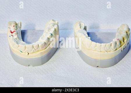 Ober- und Unterkiefer mit Farbmarkierungen in der Zahnarztpraxis, Nahaufnahme. Stockfoto
