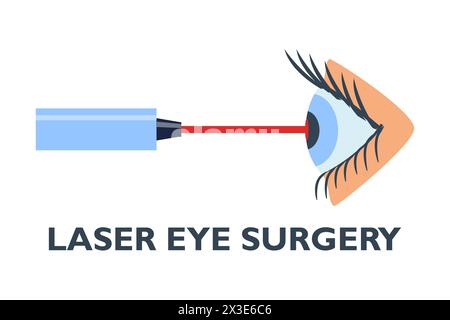 Augenlaserchirurgie, Augenheilkunde lasik-Behandlungssymbol, Vektor-Vision-medizinische Korrektur. Augenlaserchirurgie Liniensymbol für Hornhauterkrankung oder Myopie oper Stock Vektor