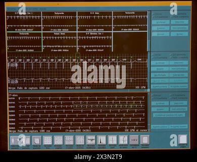 Holter-Monitoring, Hämodynamik. Krankenhaus Universitario Gran Canaria Arzt Negrin, Las Palmas de Gran Canaria. Kanarische Inseln, Spanien Stockfoto