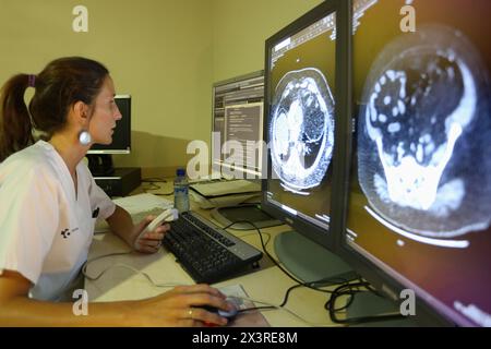 Abdominopelvic CT Scan, Radiologie Interpretation Review, Radiologie Abteilung, Donostia Hospital, San Sebastian, Donostia, Gipuzkoa, Baskenland, S Stockfoto