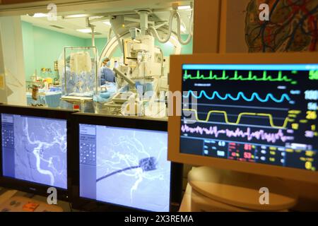 Embolisation des zerebralen Aneurysmas, Willis polygone Angiographie, interventionelle Neuroradiologie, Radiologie Abteilung, Donostia Hospital, San Sebastian, Do Stockfoto