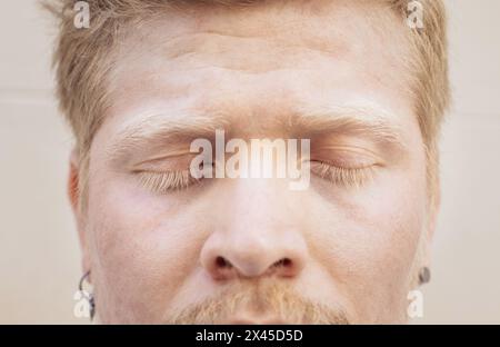 Nahporträt der Gesichtszüge eines Latino-Albino-Mannes. Seine langen weißen Wimpern schützen seine blauen Augen vor dem Sonnenlicht. Stockfoto