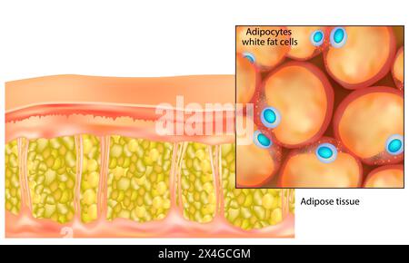 Fettgewebe. Die weißen Fettzellen der Adipozyten. Lipozyten und Fettzellen Stock Vektor