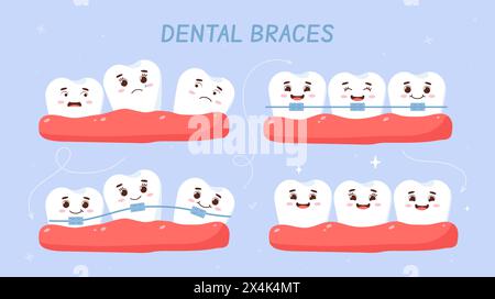 Zahnspangen-Vektorset Stock Vektor