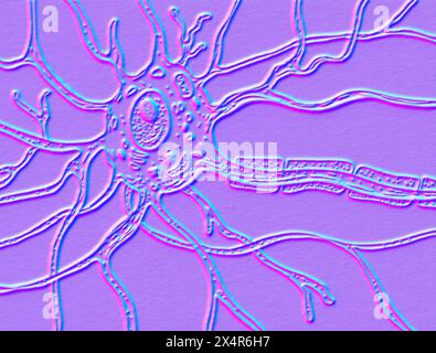 Abbildung der Motoneuronzelle mit Zellkörper mit Kernen, Dendriten und Axon. Stockfoto
