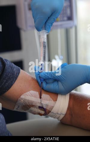 Natriumchloridlösung Kochsalzlösung Spülen zum Ausspülen der Picc Line (peripher eingesetzter Zentralkatheter) Stockfoto