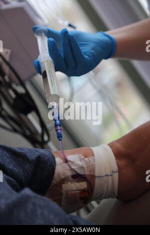 Chemotherapie-Medikament Fluorouracil wird in Picc Line des männlichen Krebspatienten im Krankenhaus Surrey England injiziert Stockfoto