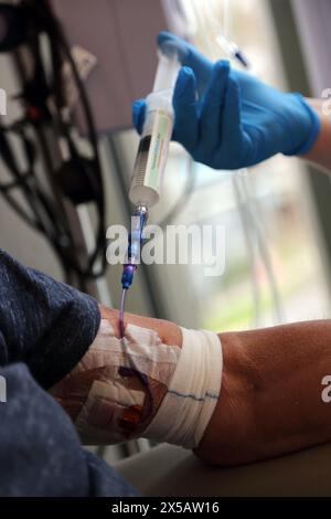 Chemotherapie-Medikament Fluorouracil wird in Picc Line des männlichen Krebspatienten im Krankenhaus Surrey England injiziert Stockfoto