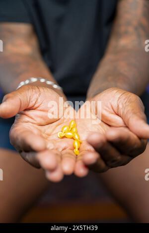 Nahaufnahme eines Mannes, der gelbe Kapseln in der Hand hält Stockfoto