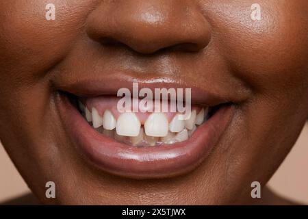 Nahaufnahme des Zahnlächelns junger Frauen Stockfoto