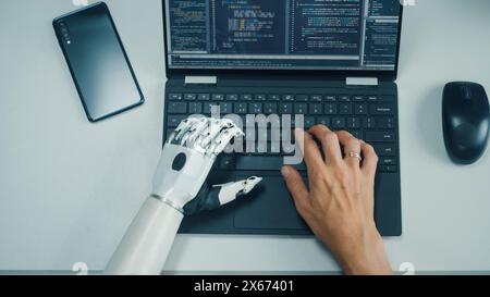 Top-Down-Ansicht: Professioneller Programmierer mit Behinderung, der eine Armprothese für die Arbeit an einem Laptop verwendet. Spezialisierter Swift und natürlicher Gebrauch von myoelektrischer bionischer Hand zum Typencode für Software Stockfoto