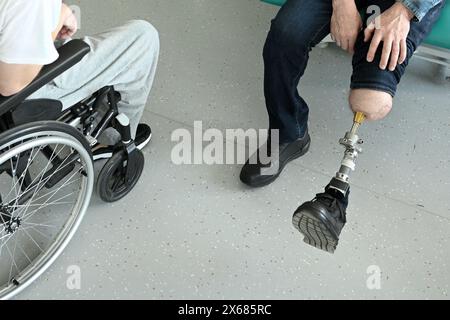 Ein Mann mit Knochen-implantierten Beinprothesen. Osteointegration Stockfoto