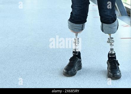 Ein Mann mit Knochen-implantierten Beinprothesen. Osteointegration Stockfoto