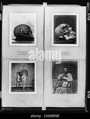 Chirurgische Fotografie ... erstellt unter der Aufsicht von ... war Department, Surgeon General's Office, Army Medical Museum, Civil war Photographs 1861-1865 Stockfoto