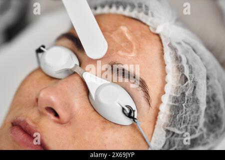 Eine Frau erhält eine IPL-Therapie in einem Schönheitssalon. Stockfoto