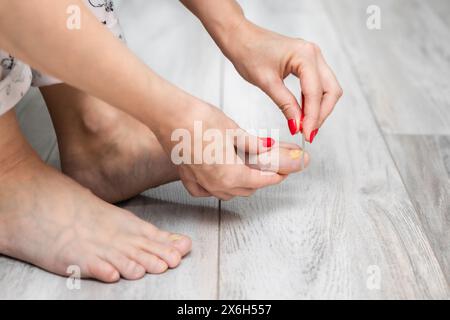 Die Frau schärft ihren Zehennagel mit einer Nagelfeile. Pediküre zu Hause. Nagelpilz. Zehennagel-Krankheit. Frau, die sich um die Zehennägel kümmert. Gelber Zehennagel. Zehennagel-Pflege Stockfoto