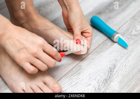 Die Frau schärft ihren Zehennagel mit einer Nagelfeile. Pediküre zu Hause. Nagelpilz. Zehennagel-Krankheit. Frau, die sich um die Zehennägel kümmert. Gelber Zehennagel. Zehennagel-Pflege. Stockfoto