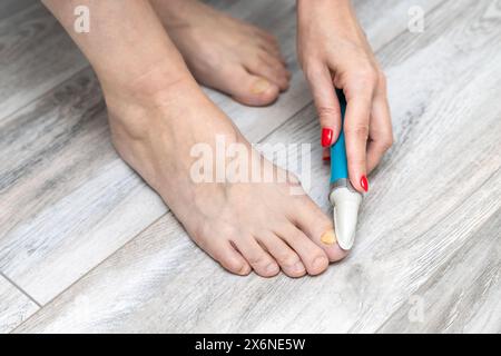 Eine Frau schleift ihre Zehennägel mit einem Schleifgerät. Nagelpilz. Zehennagel-Krankheit. Frau, die sich um die Zehennägel kümmert. Gelber Zehennagel. Elektrischer Nagelschleifer. Fürsorglich f Stockfoto