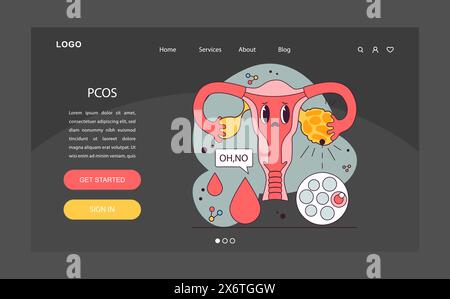 PCOS, polyzystisches Ovarialsyndrom Nacht- oder Dunkelmodus-Webbanner oder Landing-Page. Das weibliche Fortpflanzungssystem. Endokrine Systemorganerkrankungen. Das Sekretionsungleichgewicht menschlicher Hormone. Illustration des flachen Vektors Stock Vektor