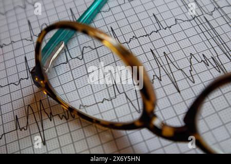 EKG-Berichte auf Blättern gedruckt. Eine Lesebrille Stockfoto