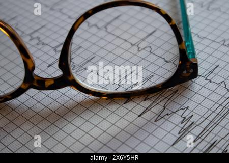 EKG-Berichte auf Blättern gedruckt. Eine Lesebrille Stockfoto