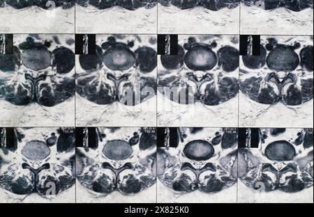 Magnetcomputertomographisches Foto von Frauen Stockfoto