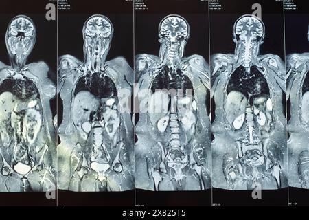 Magnetcomputertomographisches Foto von Frauen Stockfoto
