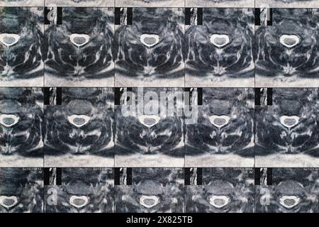 Magnetcomputertomographisches Foto von Frauen Stockfoto