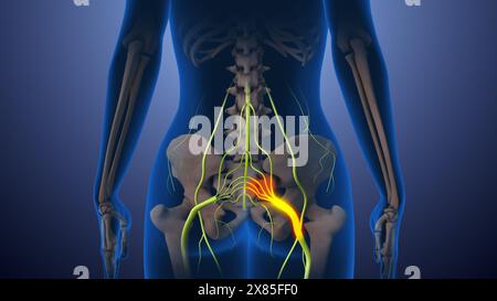 Schmerzen des Nervus Ischias im unteren Rücken durch die Hüften bis zum Bein Stockfoto