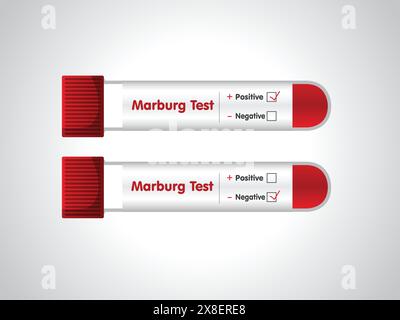 Blutprobenröhrchen positiv für Marburg-Virus, Blut im Reagenzglas. Vektorabbildung. Das Blutfläschchen und das Testkit. Es kann in der Medizin verwendet werden Stock Vektor